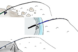 竿・仕掛けの種類